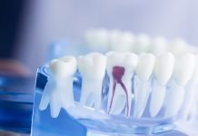 How can you get the best root canal treatment from professional dental clinic? root canal treatment