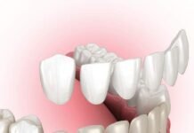 Dental Care in Oshawa: A Comprehensive Guide to Maintaining Your Oral Health