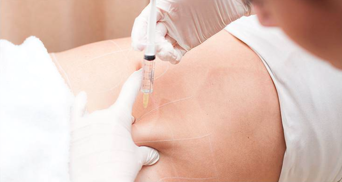 Lemon bottle injection Lemon bottle injection
