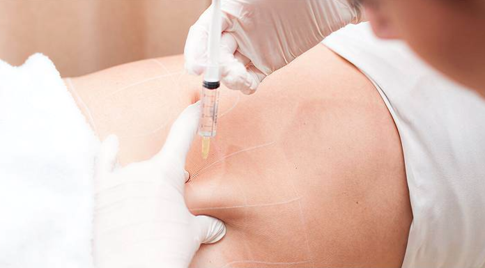 Lemon Bottle Injection – A Modern Non-Surgical Fat Reduction Solution in the UAE Lemon bottle injection