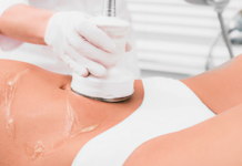Venus Legacy Fat Reduction: Benefits, Results and Treatment Options Venus Legacy fat reduction
