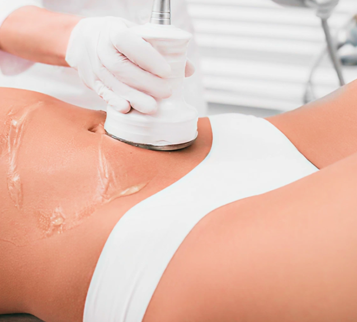 Venus Legacy fat reduction Venus Legacy fat reduction