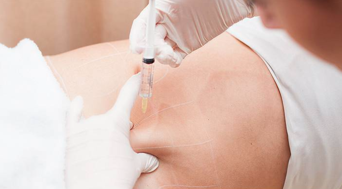 Fat Dissolving Injection Dubai: Types, Areas, Cost & What to Expect (2026 Guide) Fat Dissolving Injection Dubai